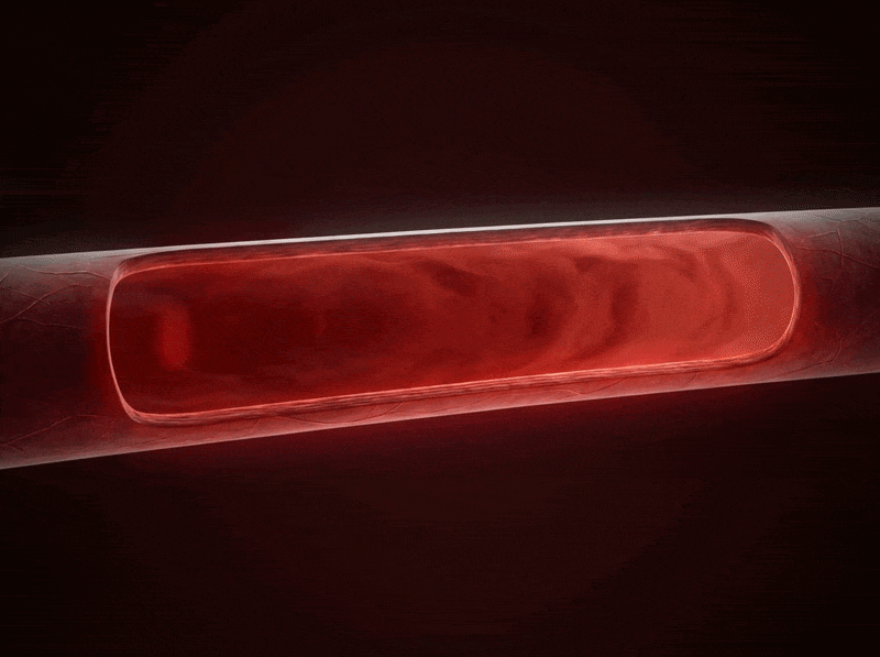 A blood vessel constricting